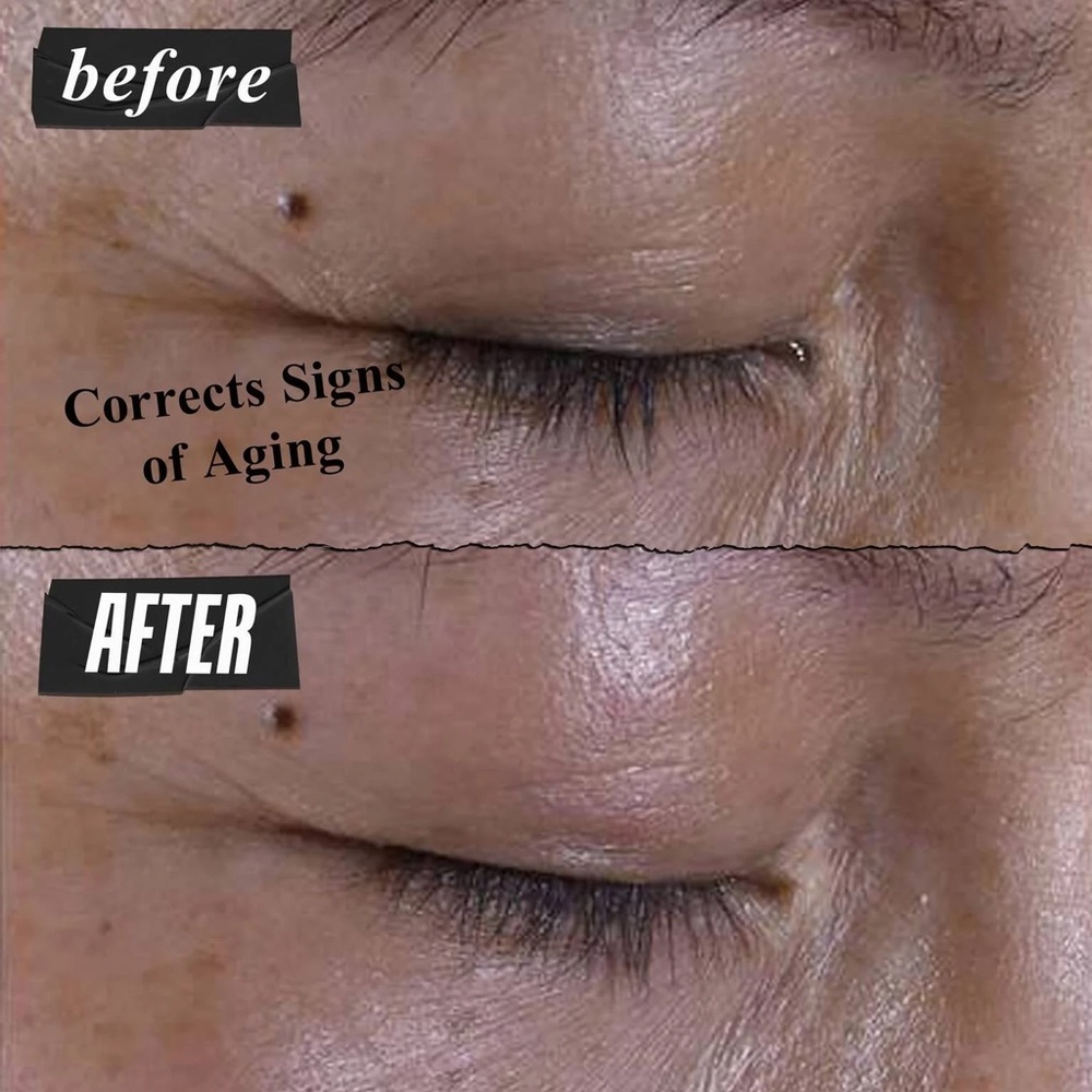 Kiehl's Super Multi-Corrective Eye Zone Treatment Anti-aging Eye Cream.95oz 28ml - Picture 3 of 6